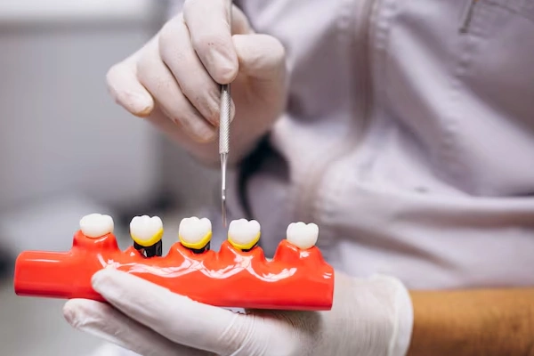 Dental crowns and bridges