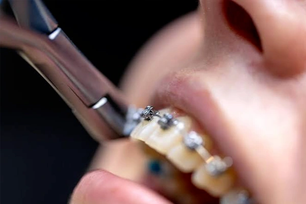 Pediatric Dentistry
