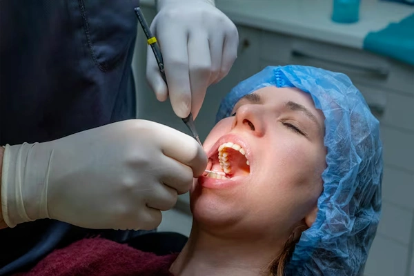 Gum surgery