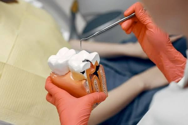 Periodontics Gum Treatment