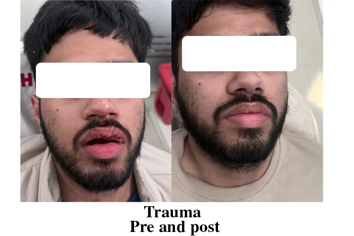 Dental trauma management