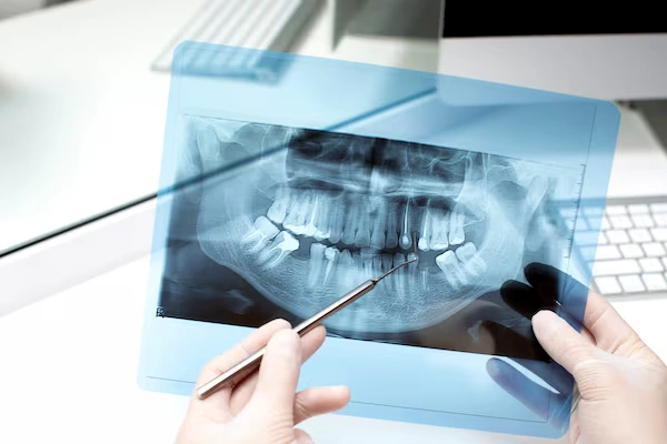 CBCT Scan
